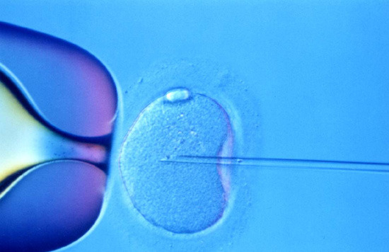 Kościół Bułgarii: in vitro tak, ale...