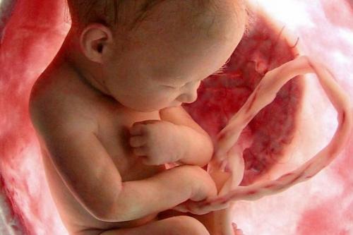 "Ty utkałeś mnie w łonie mej matki", czyli o aborcji w Rosji